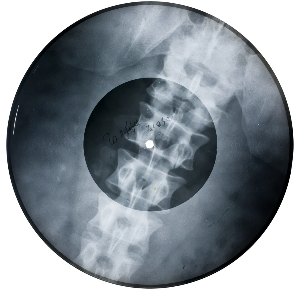 Soviet Russian Underground X-Ray Music Bone Record
