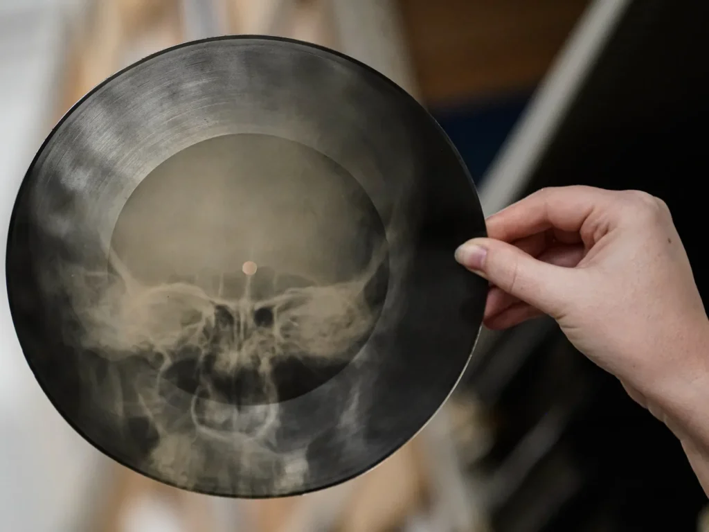 Soviet Russian Underground X-Ray Music Bone Record