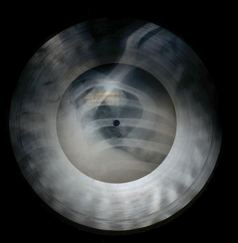 Soviet Russian Underground X-Ray Music Bone Record