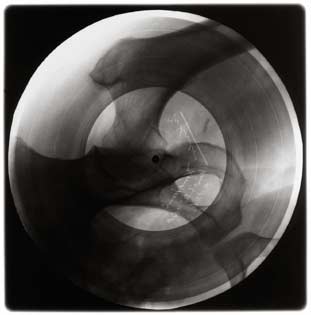 Soviet Russian Underground X-Ray Music Bone Record
