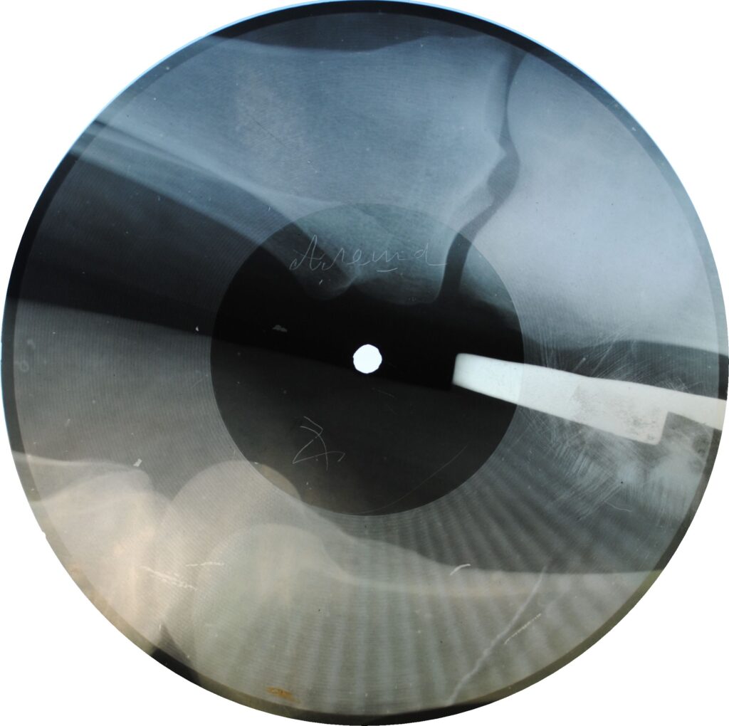 Soviet Russian Underground X-Ray Music Bone Record