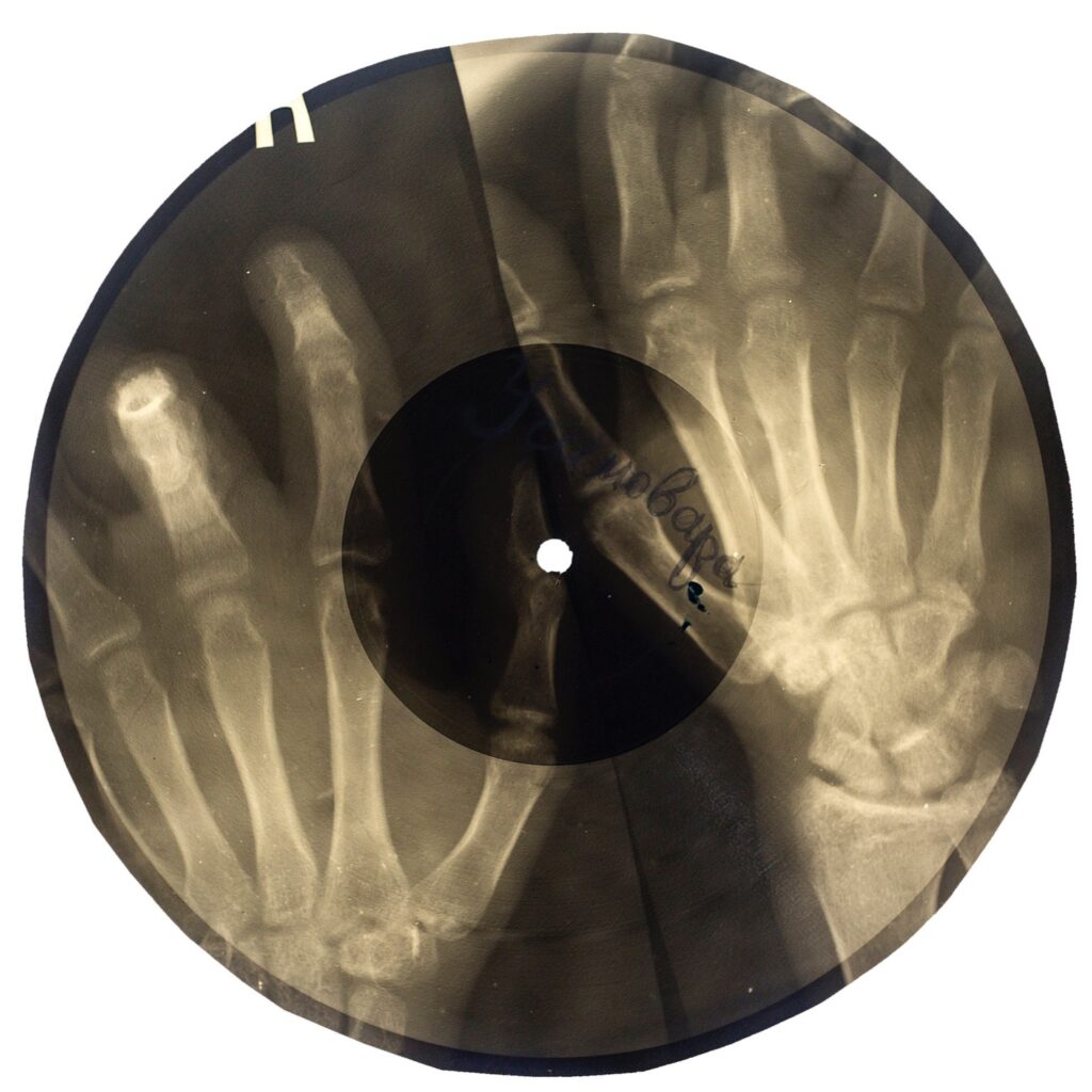 Soviet Russian Underground X-Ray Music Bone Record