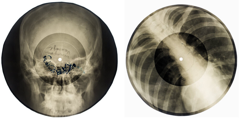 X‑Rays You Can Hear: Soviet Bootleg Music’s Non-Clinical Birth, Death, and Rebirth