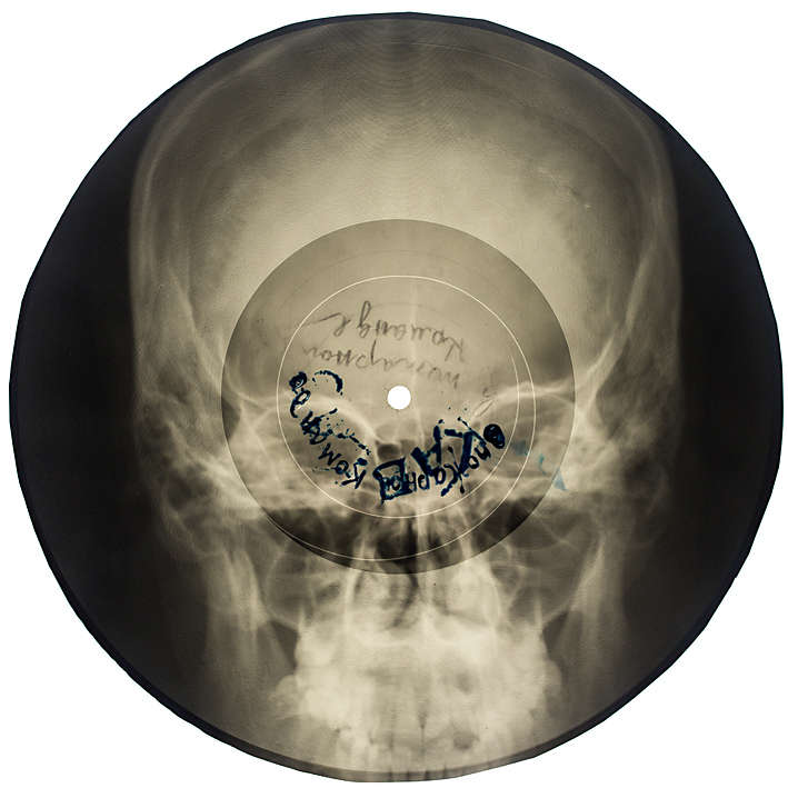 Soviet Russian Underground X-Ray Music Bone Record