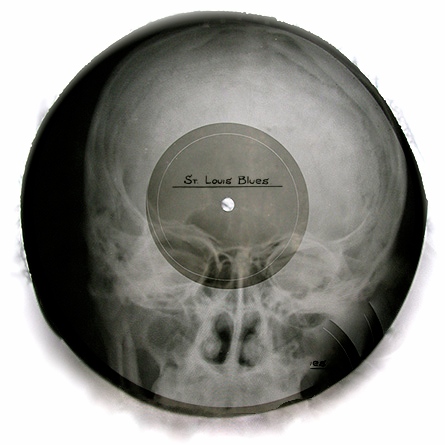 Soviet Russian Underground X-Ray Music Bone Record