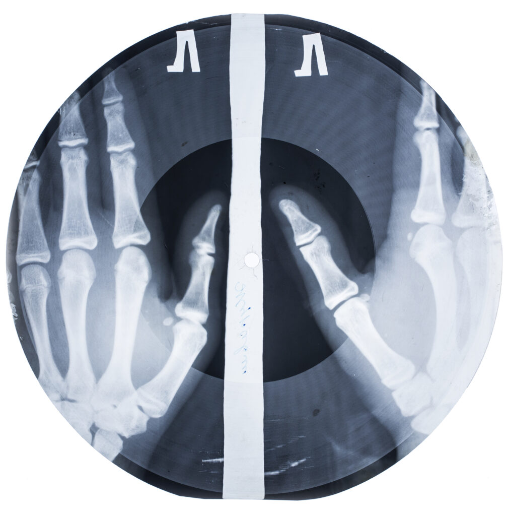 Soviet Russian Underground X-Ray Music Bone Record