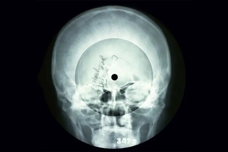 Soviet Russian Underground X-Ray Music Bone Record