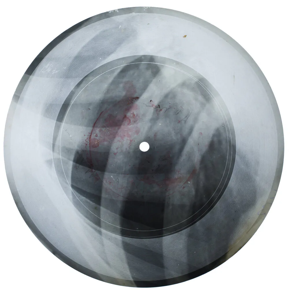 Soviet bootleg x-ray records