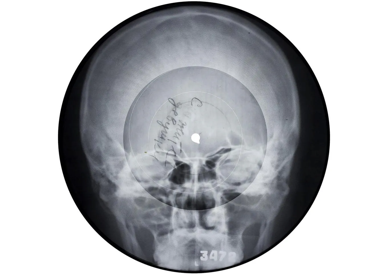 Soviet bootleg x-ray records