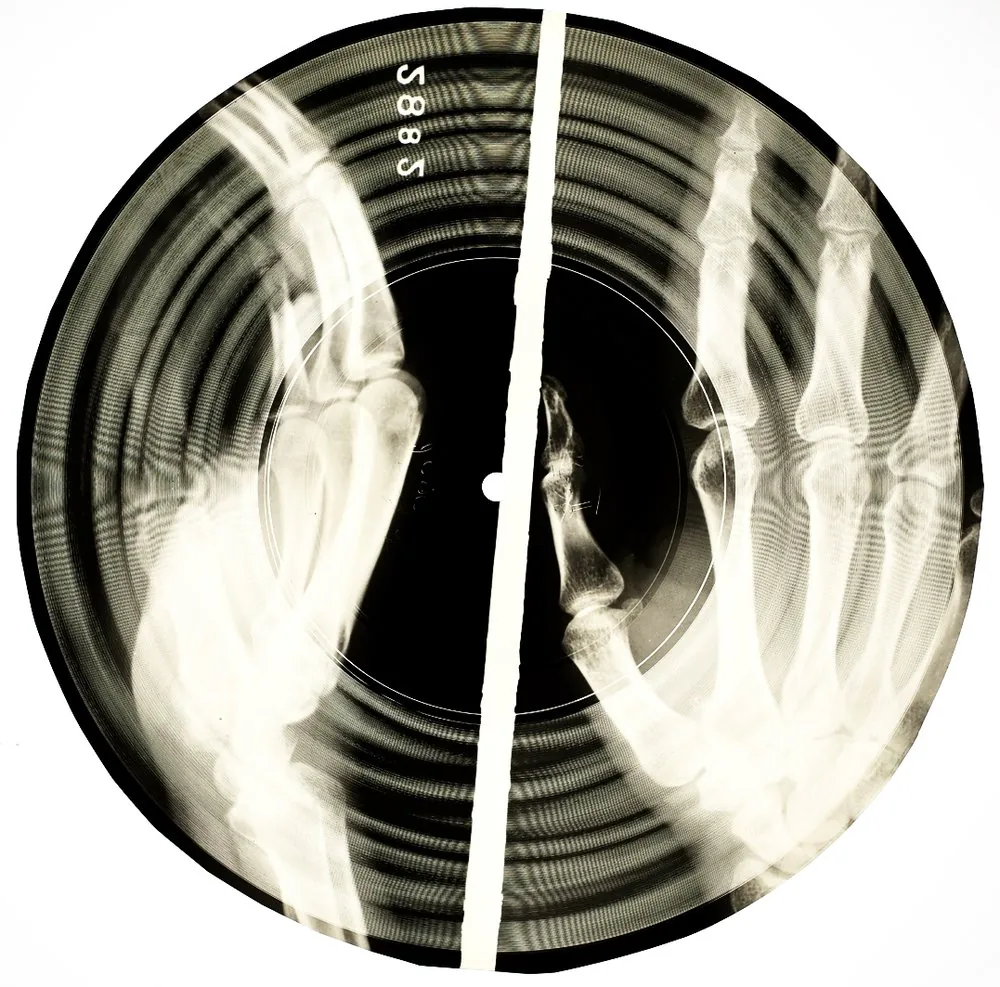 Soviet bootleg x-ray records