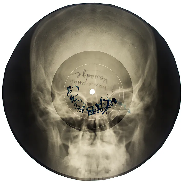 Soviet bootleg x-ray records