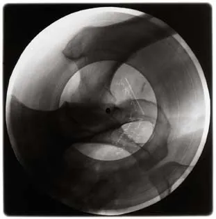 Soviet bootleg x-ray records