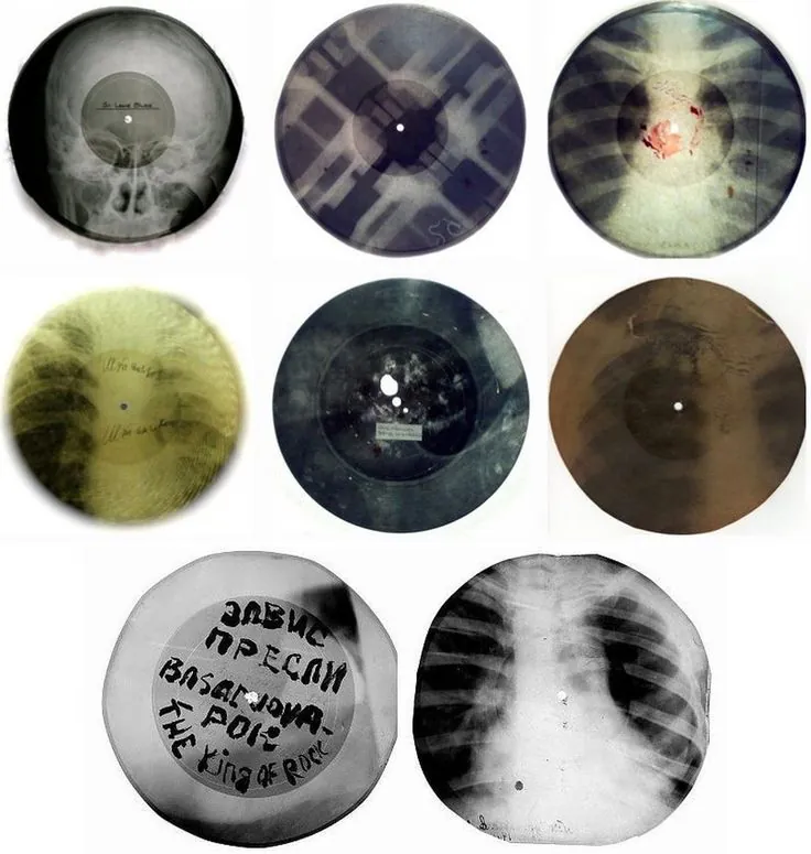 Soviet bootleg x-ray records