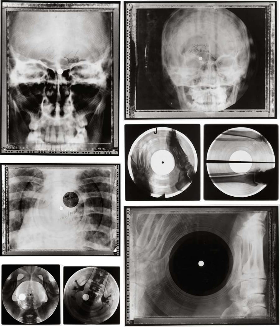 Soviet Russian Underground X-Ray Music Bone Record
