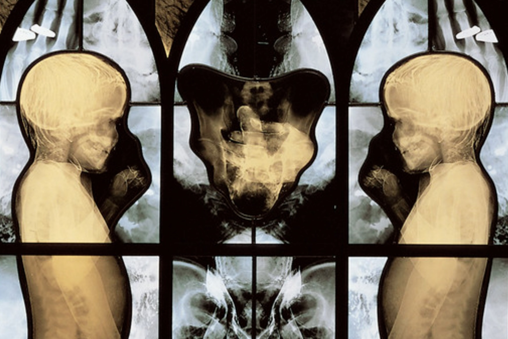 A Skeleton in the Church Window: Wim Delvoye’s X‑Ray Stained Glass